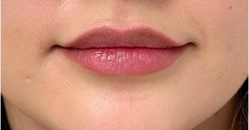 After treatment