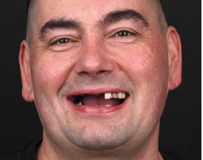 Before treatment